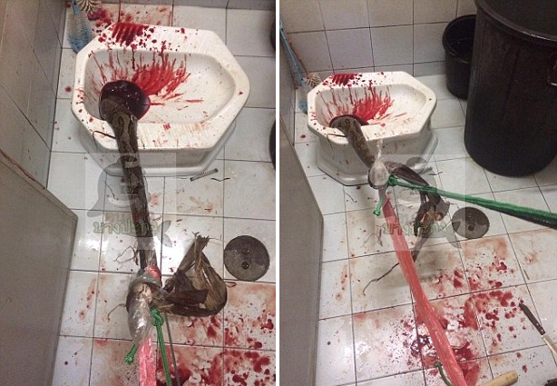 Thai Man's Genitals Gets Bitten By Python As He Was Using The Toilet - World Of Buzz