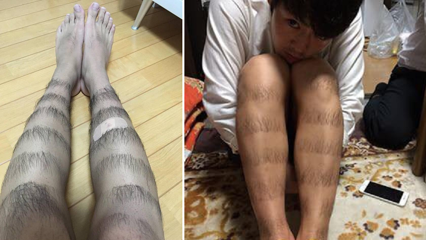 Malaysian Guy Goes Viral For Styling His Leg Hair - World Of Buzz