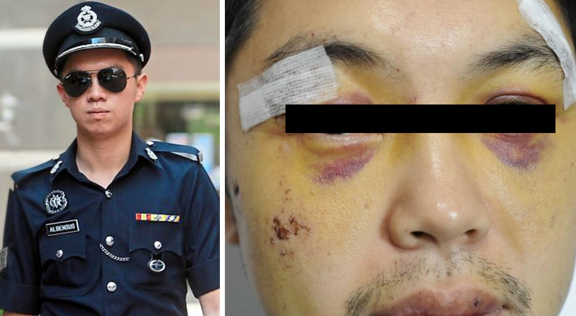 Man Lodges Police Report After Being Assaulted, Finds Out They Were Actually Cops! - World Of Buzz