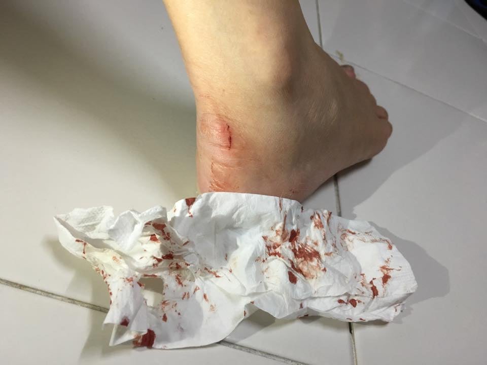 Moviegoer In Gsc Malacca Receives Shock Of His Life When His Foot Was Bitten By A Rat - World Of Buzz