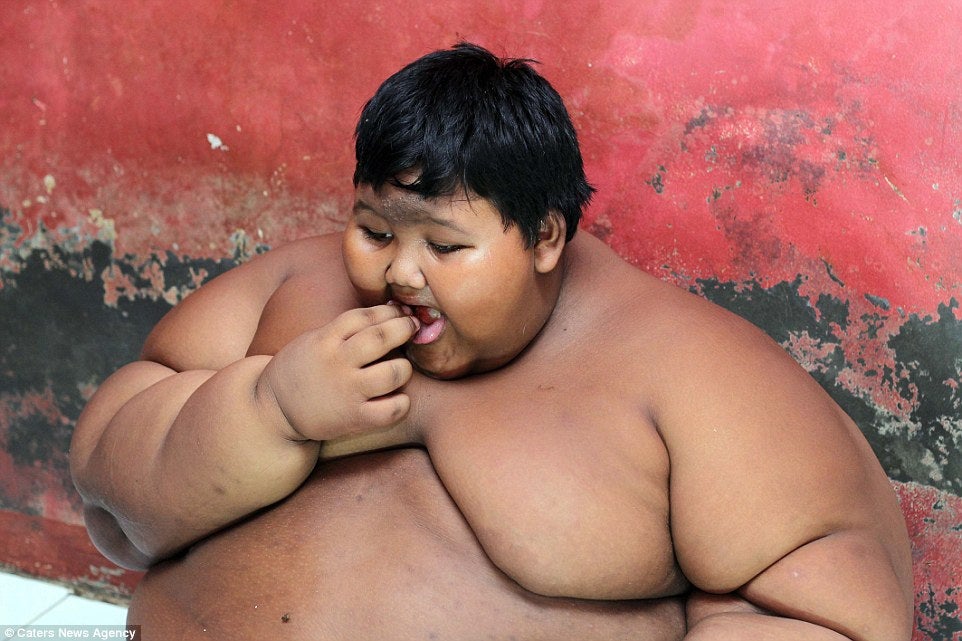 Obese 10-Year Old Boy Weights As Much As An Adult Male Lion - World Of Buzz 3