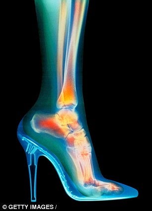 Wearing High Heels Too Often Increases Risk Of Cancer Specialists Warn - World Of Buzz 1