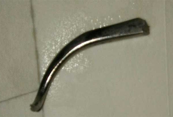 Surgical Instrument Left Inside A Woman After An Operation In India - World Of Buzz