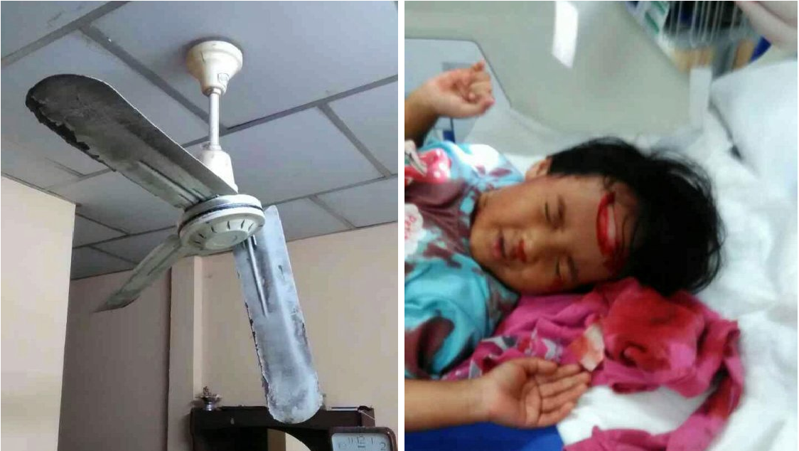 Toddler'S Head Spilt Open When Her Father Threw Her Into The Air - World Of Buzz 1