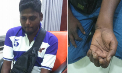 Malaysian Bus Driver Worked 3 Years With Broken Arm, Says Money Better Spent On Family - World Of Buzz 2