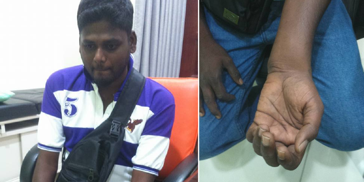 Malaysian Bus Driver Worked 3 Years With Broken Arm, Says Money Better Spent On Family - World Of Buzz 2