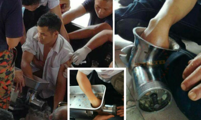 Malaysian Male Accidentally Gets Hands Stuck In Meat Grinder, Seeks Help By Himself - World Of Buzz 1