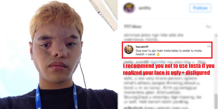 Malaysian Receives Extremely Nasty Comments About His Face, Strangers Step In To Support - World Of Buzz