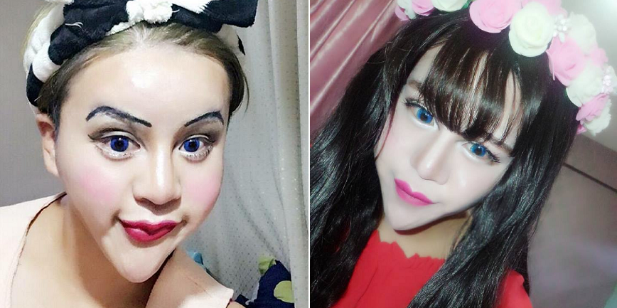 Chinese Shocks World With Intense Plastic Surgery For Bizarre 'Beauty' - World Of Buzz 10