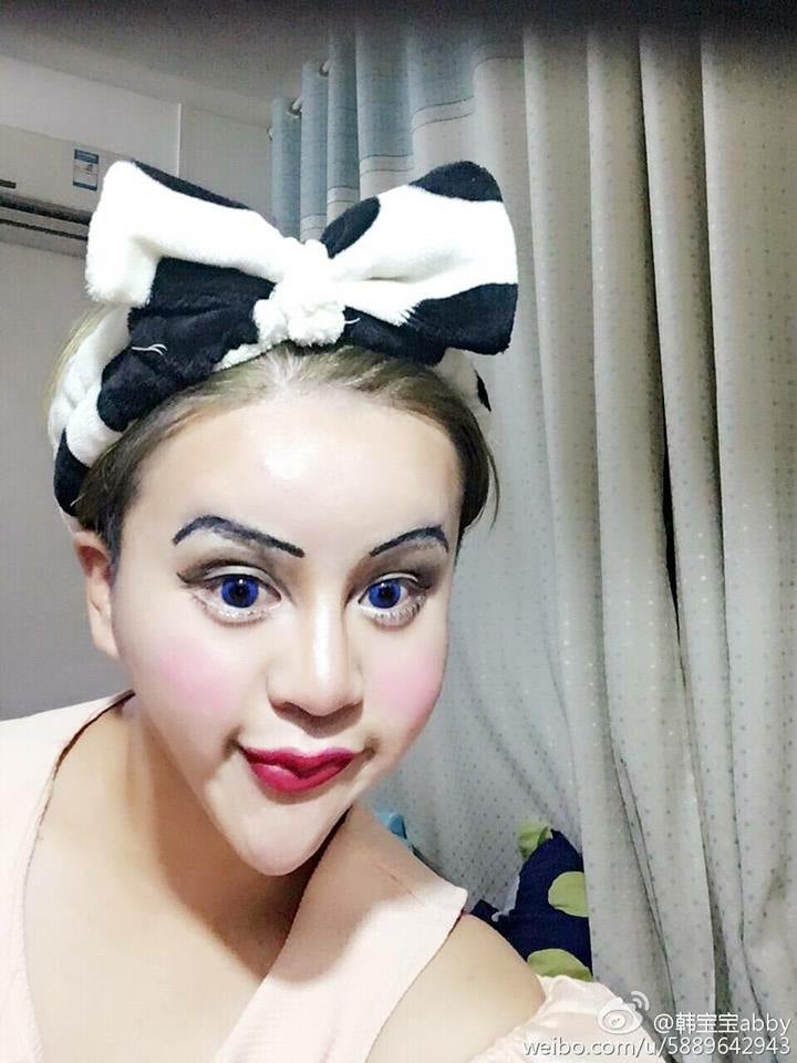 Chinese Shocks World With Intense Plastic Surgery For Bizarre 'Beauty' - World Of Buzz 8