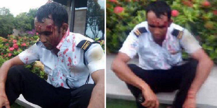 Husband Bashes Security Guard Bloody After He Tried To Molest Wife - World Of Buzz 4