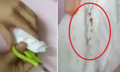 Woman Found Dark Spots In Newly Bought Pantyliner - World Of Buzz 5