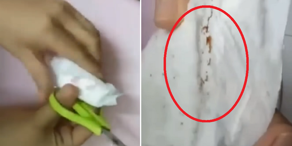 Woman Found Dark Spots In Newly Bought Pantyliner - World Of Buzz 5