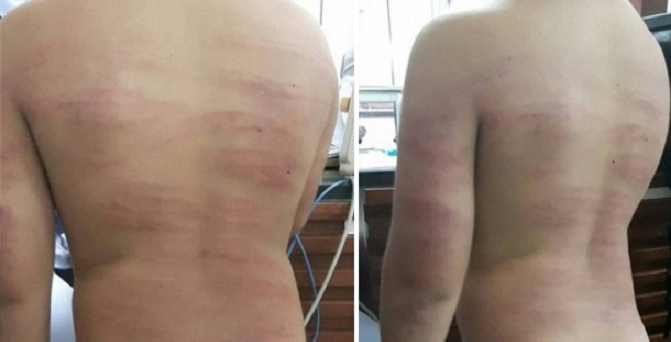 7-Year-Old Primary School Student Caned 99 Times For Wanting To Leave Class Early - World Of Buzz