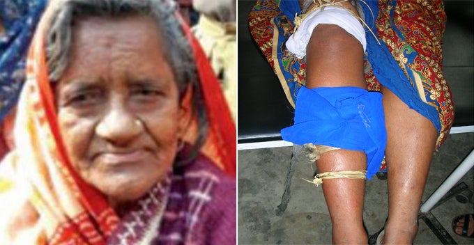 Indian Woman Died From Cobra-bite, Comes Back To Live After 40 Years - World Of Buzz 4