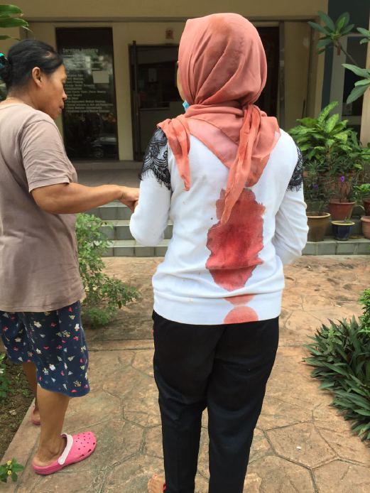 Indonesian Maid Brutally Abused By Malaysian Employer - World Of Buzz