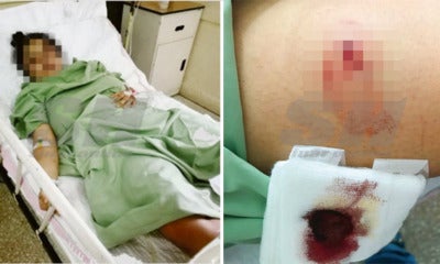 Malaysian Female Postgraduate Student Stabbed And Tortured For 3 Days By Sadistic Ex-Bf - World Of Buzz 2