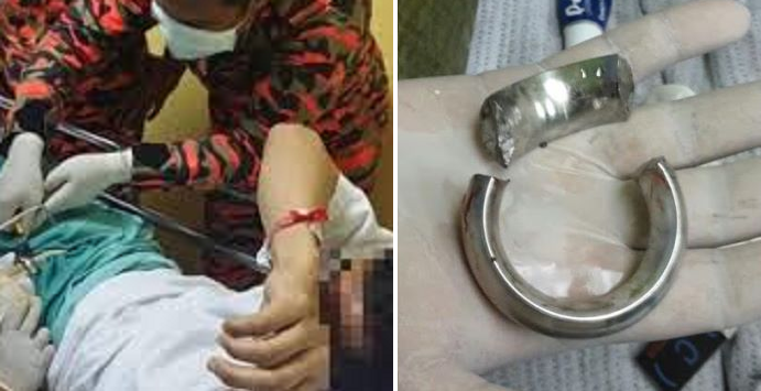 Metal Ring Stuck Around Malaysian Man's Penis Removed by Firefighters - World Of Buzz 4