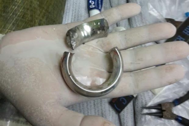 Metal Ring Stuck Around Malaysian Man's Penis Removed By Firefighters - World Of Buzz