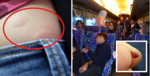 Passengers En Route On Express Bus To Singapore Suffers Bites From Bed Bugs For 8 Hours - World Of Buzz
