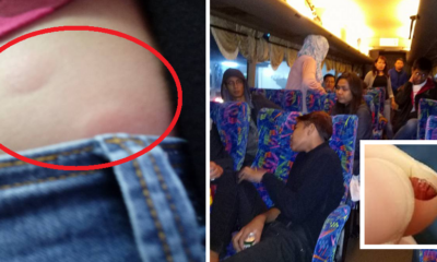 Passengers En Route On Express Bus To Singapore Suffers Bites From Bed Bugs For 8 Hours - World Of Buzz
