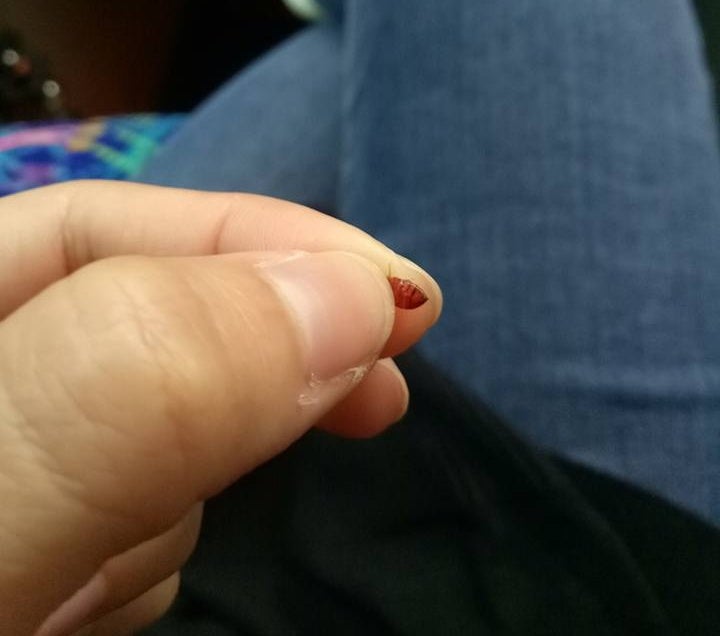 Passengers Suffered Bites From Bed Bugs For 8 Hours On Express Bus From Kl To S'pore - World Of Buzz 3