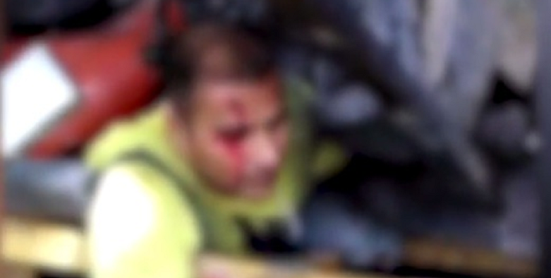 Worker'S Leg Pinned Under Debris, Forced To Amputate On Scene To Keep His Life - World Of Buzz 3