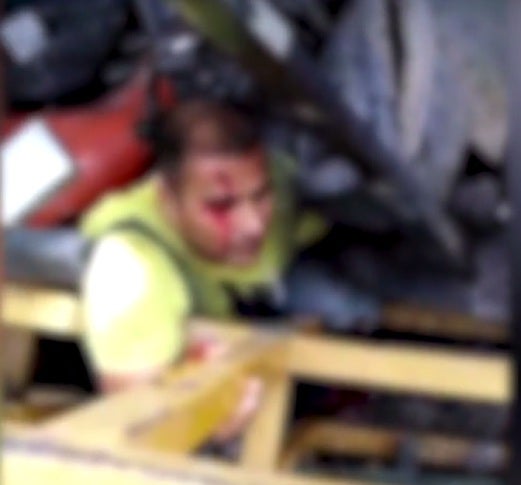 Worker's Leg Pinned Under Debris, Forced To Amputate On Scene To Keep His Life - World Of Buzz