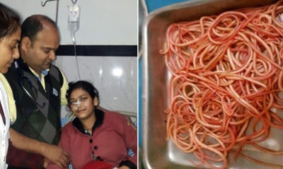150 Wriggling Worms Removed From Lady'S Stomach After Consuming Unhygienic Food That Contains Worm Eggs - World Of Buzz 3