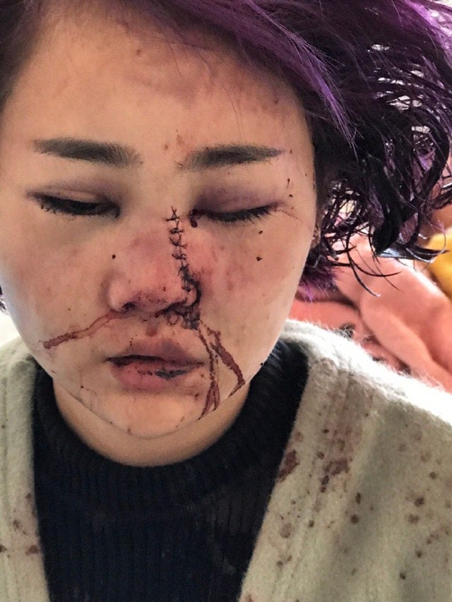 China Police accused of covering up brutal tourist attack!? - World Of Buzz 1
