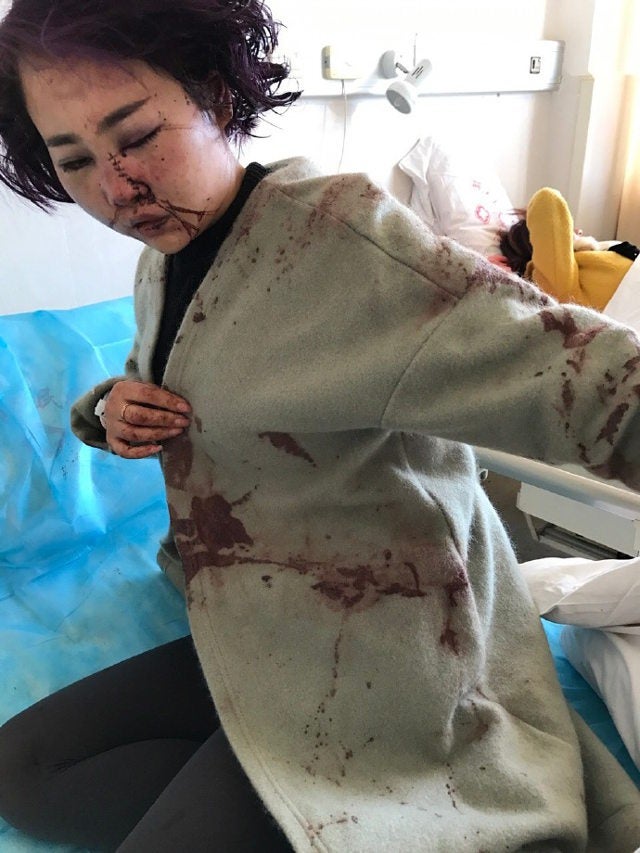 China Police accused of covering up brutal tourist attack!? - World Of Buzz 3