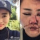 China Police Accused Of Covering Up Brutal Tourist Attack!? - World Of Buzz