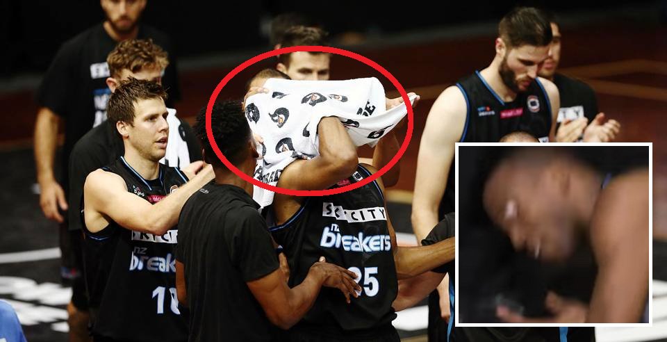 Freak Accident Caused Basketball Player'S Eye To Pop Out!? - World Of Buzz 5