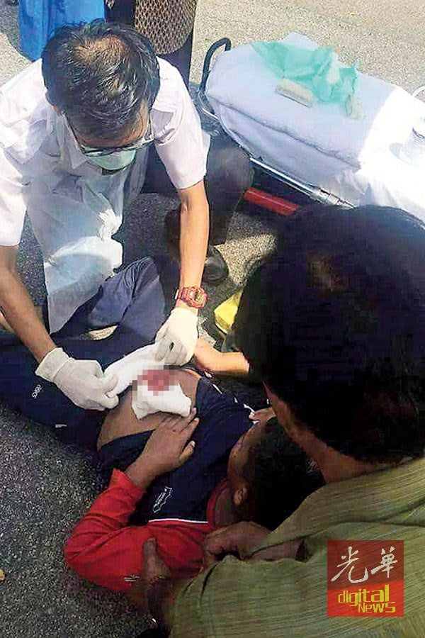 Malaysian Boy's Small Intestines Exposed After Stomach Penetrated By Bicycle Handle - World Of Buzz 1