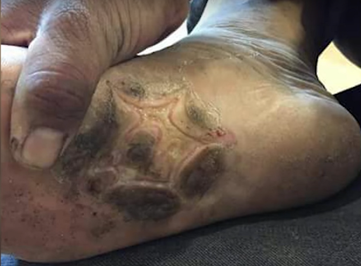 Malaysian Man Punched And Burnt By Exhaust Pipe For Not Meeting Sales Target - World Of Buzz