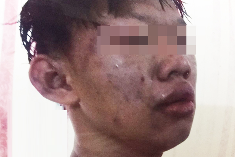 Student Brutally Beaten By Gangsters For Refusing Gang Invitation. - World Of Buzz 3