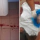 19-Year-Old Student Wraps Newborn Baby In Plastic Bag And Disposes In Dustbin - World Of Buzz