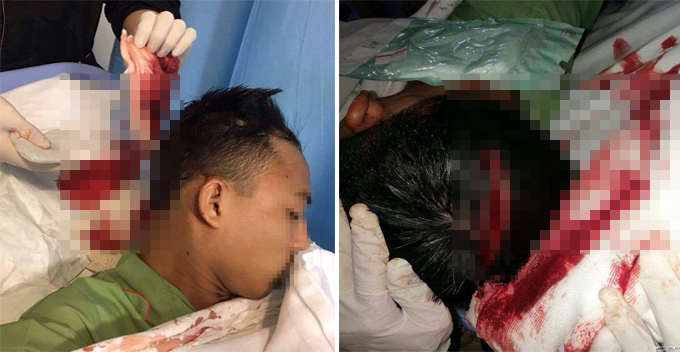 Snatch Thief Brutally Hacked Student's Head For Not Giving Up His Power Bank - World Of Buzz 1