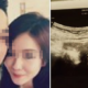 S'Porean Girl Aborts Baby For Boyfriend, But He Blamed Her Having To Pay The Abortion Fee - World Of Buzz 1