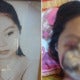 Vietnamese Girl'S Face 'Eaten' By Bacteria Due To Sinus Infection - World Of Buzz