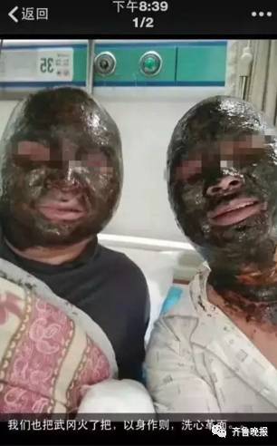 Four Chinese Men's Burn Injuries Turned Their Faces Black In Mahjong Table Explosion - World Of Buzz 2