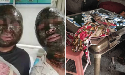 Four Chinese Men'S Burn Injuries Turned Their Faces Black In Mahjong Table Explosion - World Of Buzz 5