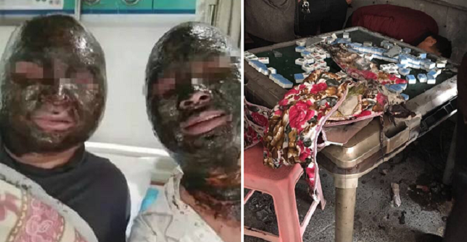 Four Chinese Men'S Burn Injuries Turned Their Faces Black In Mahjong Table Explosion - World Of Buzz 5