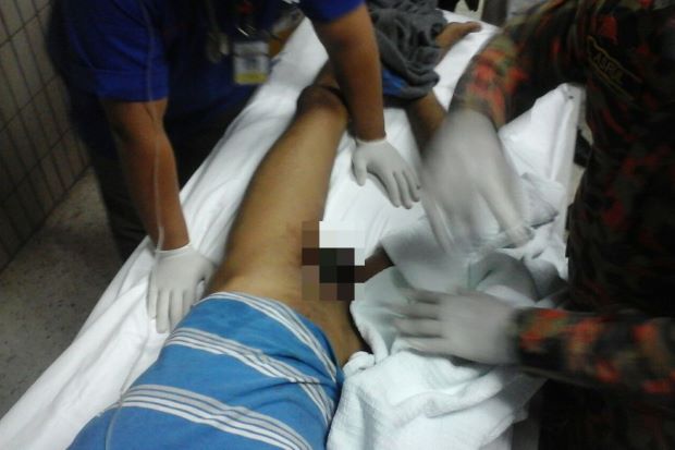 Malaysian Man Suffered 12 Hours Of Pain After Penis Ring Could Not Come Off - World Of Buzz 1
