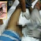 Malaysian Man Suffered 12 Hours Of Pain After Penis Ring Could Not Come Off - World Of Buzz 4