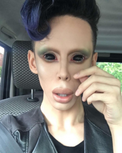 Man Gets over 100 Plastic Surgery Procedures to "Look like an Alien" - World Of Buzz 3
