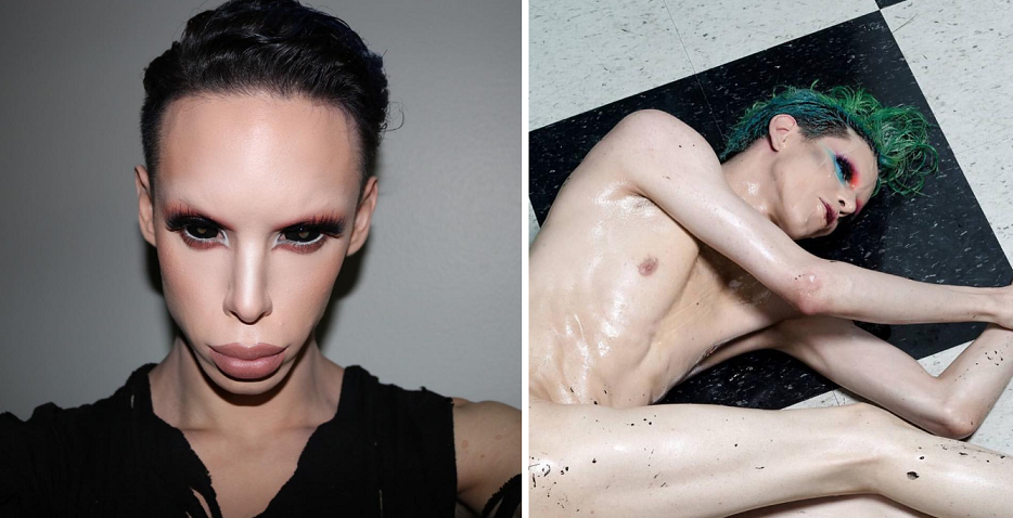Man Gets Over 100 Plastic Surgery Procedures To &Quot;Look Like An Alien&Quot; - World Of Buzz 8
