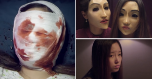 Man Spends Over Rm200,000 On Plastic Surgery To &Quot;Look Like An Alien&Quot; - World Of Buzz