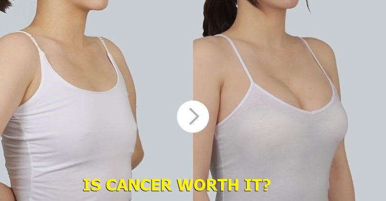 Recent Study Has Shown A Shocking Link Between Breast Implants And Cancer - World Of Buzz 1