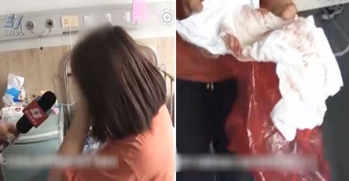 1-Year-Old Baby Sexually Assaulted By Chinese Man, Diaper Covered In Blood - World Of Buzz